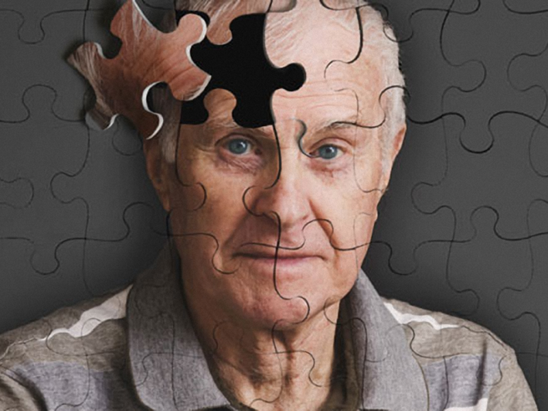 Demencia senil: En qué consiste y cómo se trata